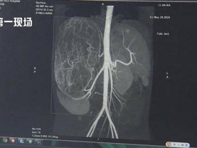 17岁女孩确诊癌症！买衣服时店员看出端倪……这个细节很重要！